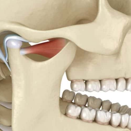 trouble articulaire ou musculaire au niveau de votre mâchoire